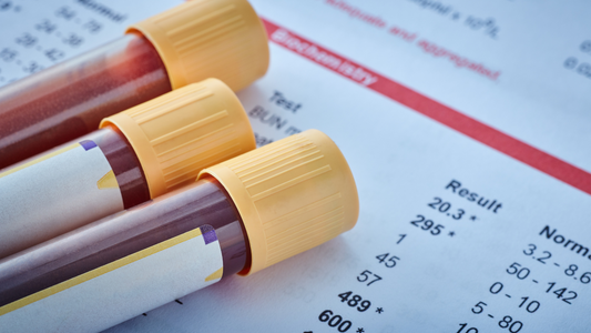 ケトン体の測り方は「呼吸」「尿」「血液」からされるって知ってた？！